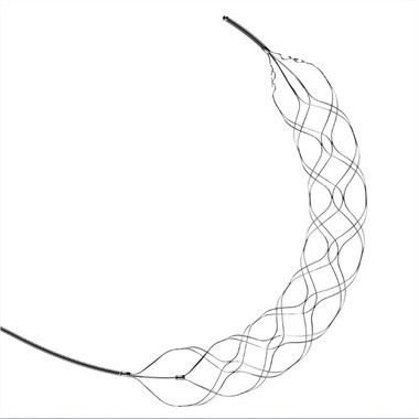 Odstranljiva stent trombektomija